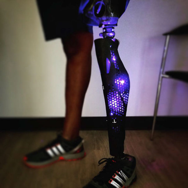 This Company Is Making Fashionable Leg Prosthetics And They Look