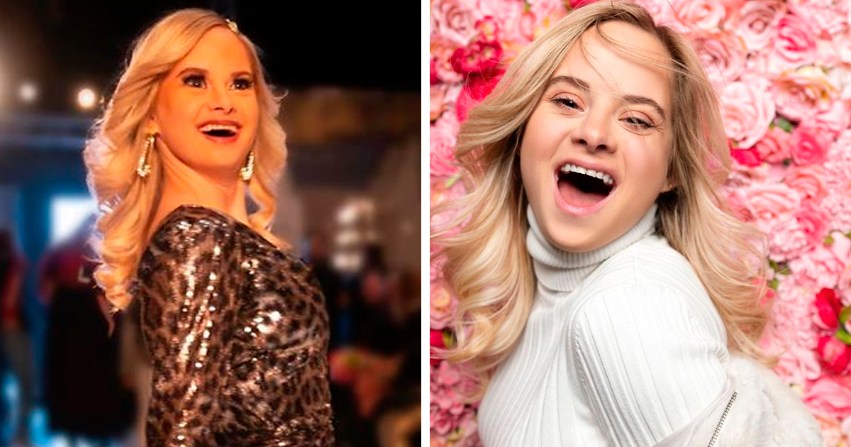 This Model With Down Syndrome Fulfilled Her Dream Of Modeling At New ...