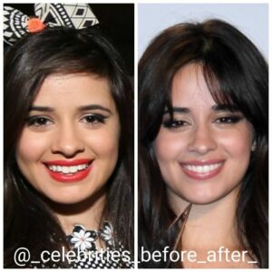 20 Side-By-Side Photos Of Celebrities Showing How Much They've Changed