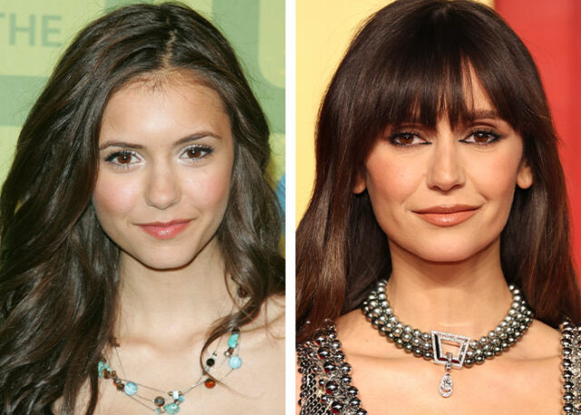 15-celebrities-who-look-wholly-different-because-of-plastic-surgery