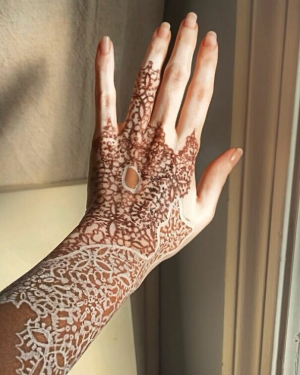 Amara Aleman’s “ArtSpots” Transforming Vitiligo Into Vibrant Art (20